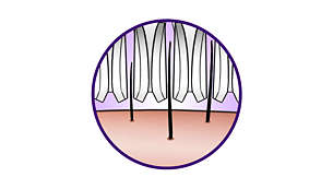 Les pinces en céramique hygiéniques permettent d'attraper et de retirer les poils, même les plus fins