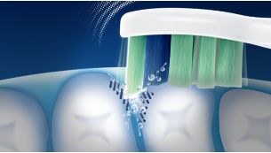 Un nettoyage plus efficace des endroits difficiles à atteindre qu'avec une brosse à dents manuelle