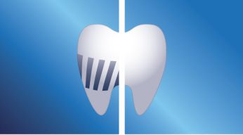 Removes up to 2 times more plaque than a manual toothbrush