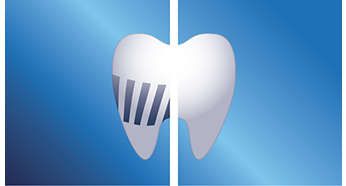 Odstrani do 2-krat več zobnih oblog kot običajna zobna ščetka