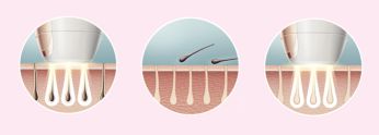 Enjoy smooth skin every day