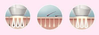 Enjoy smooth skin every day