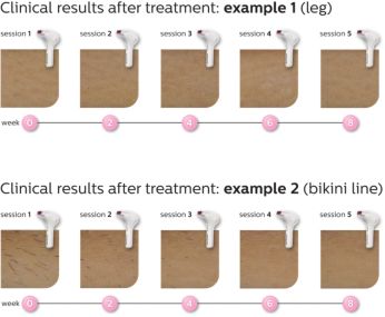 Effortlessly effective