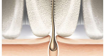 Epilation head of unique ceramic material for better grip