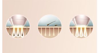 Ù…Ø³ØªÙˆØ­Ø§Ø© Ù…Ù† ØªÙ‚Ù†ÙŠØ© IPL Ø§Ù„Ø§Ø­ØªØ±Ø§ÙÙŠØ© ÙˆÙ…Ø·Ù‘ÙˆØ±Ø© Ø¹Ù„Ù‰ ÙŠØ¯ Ø£Ø·Ø¨Ø§Ø¡ Ø§Ù„Ø£Ù…Ø±Ø§Ø¶ Ø§Ù„Ø¬Ù„Ø¯ÙŠØ©