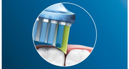 Élimine jusqu'à 10 fois plus de plaque qu'une brosse à dents manuelle