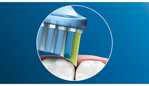 Až 10x lepší odstranění plaku než manuálním zubním kartáčkem