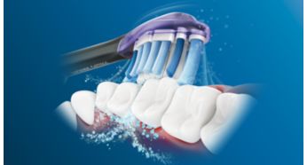 A Philips Sonicare továbbfejlesztett szónikus technológiája