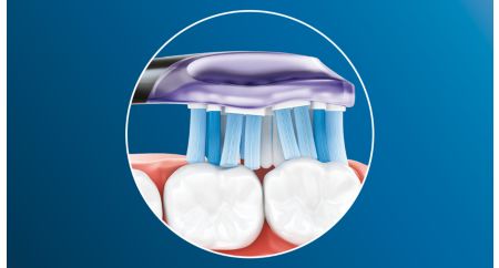 在牙刷順著牙齦線移動時,刷頭柔軟的側面和刷毛可吸收任何多餘的壓力