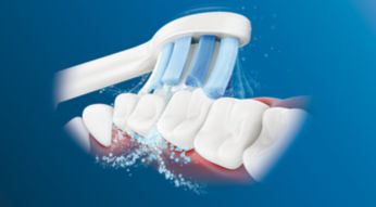 Dynamic sonic action drives fluid between teeth