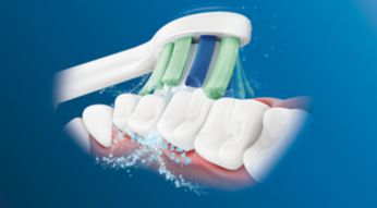 Dynamic sonic action drives fluid between teeth