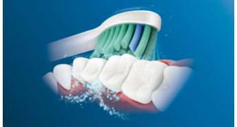 飞利浦 Sonicare 先进的声波技术