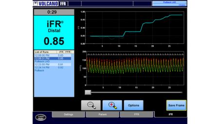 Retrait iFR Scout