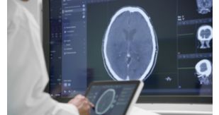 Stroke Treatment