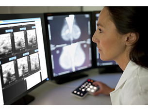IntelliSpace Radiology con Advanced Mammography Mamografía diagnóstica