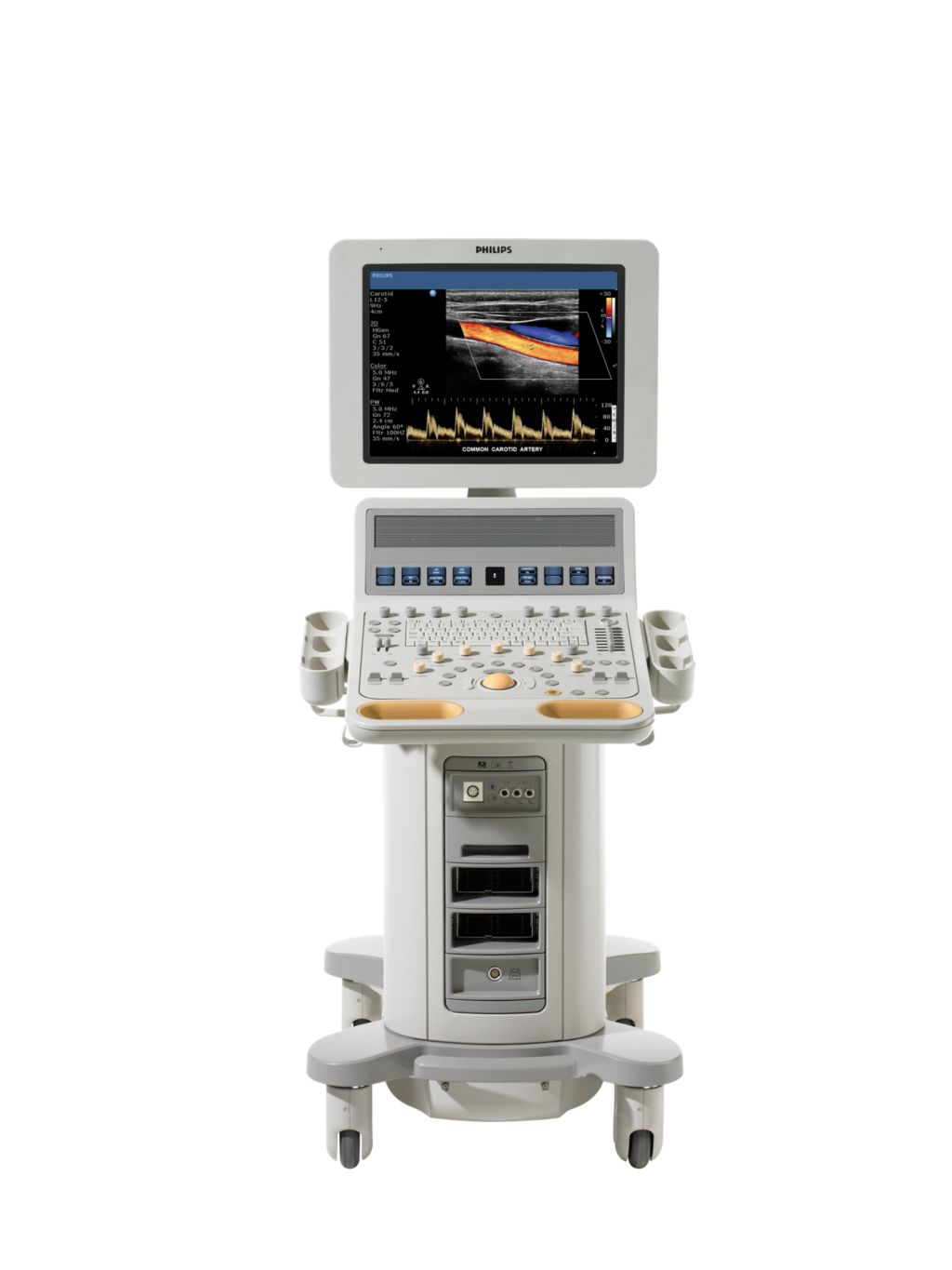 HD Ultrasound system