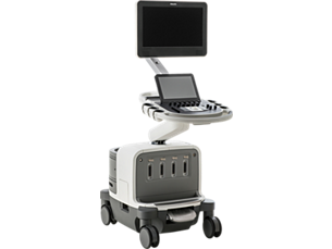 EPIQ Mobiles Präzisisions-Ultraschallsystem