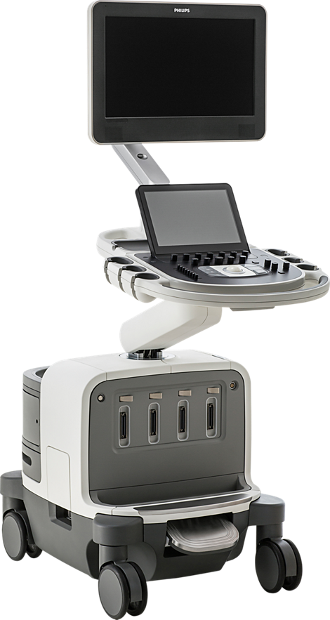 EPIQ Ultrasound system for obstetrics and gynecology