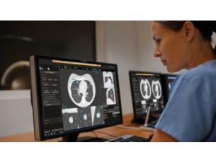 IntelliSpace Portal 8,0 Toutes vos analyses avancées ont besoin d’une solution complète