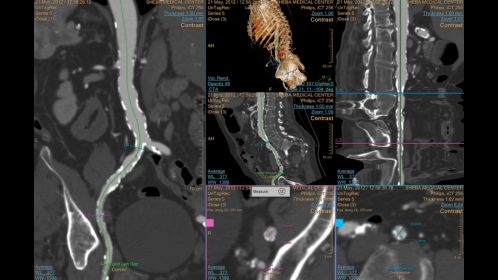 Philips Dicom Viewer R2.3