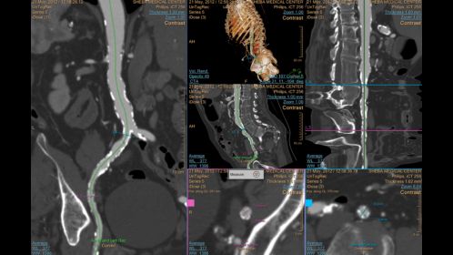 Philips Dicom Viewer R2.3