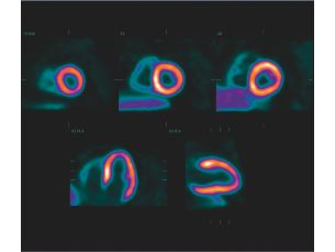 - Cedars-Sinai Cardiac Suite 2013