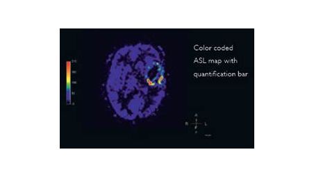 Non-contrast brain perfusion