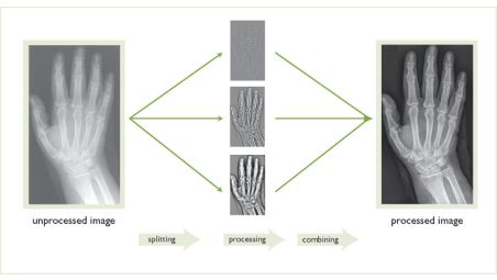 Imágenes de diagnóstico de calidad uniforme
