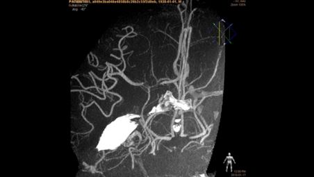 使用静脉内成像作重要决定时需要的信息