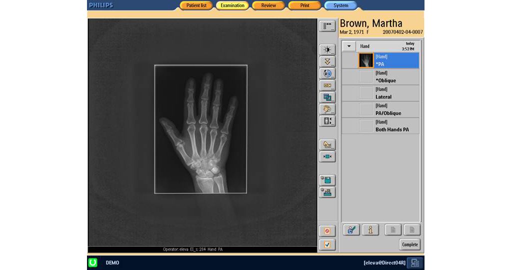 Easy, intuitive to operate || KBA1