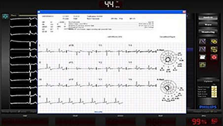 Proven ECG technology - Assess patient status during procedure