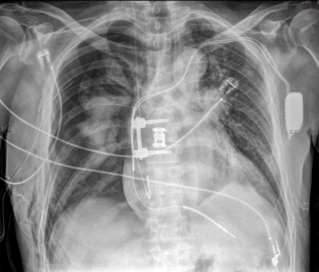 Fast chest exam imaging || KBA1