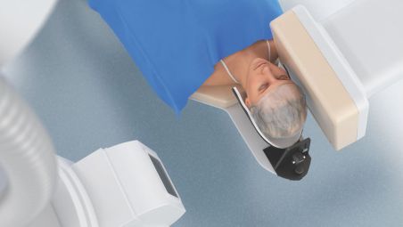 PerfectFit FD20/15 detector design:
Full access and brain coverage