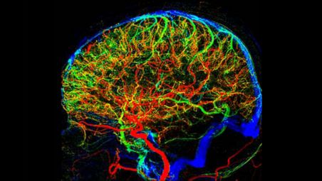 2D Perfusion: 
Easily identify perfusion differences