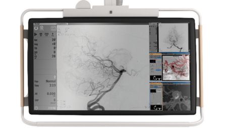 FlexVision XL display: 
Zoom images at full resolution