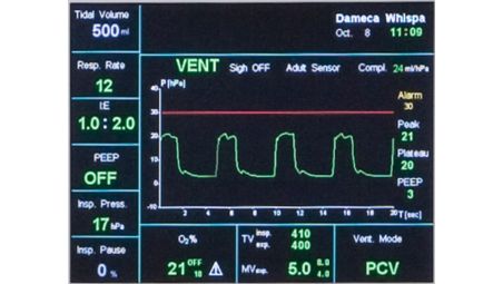 Designed to provide consistent ventilation