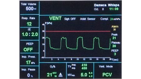 Designed to provide  consistent ventilation