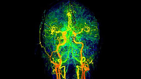 Access new imaging capabilities  for stroke workflow
