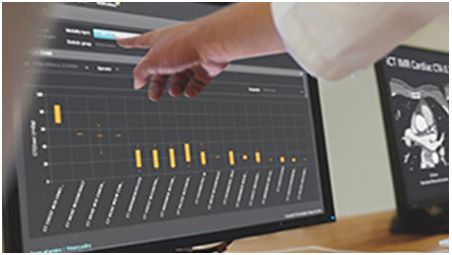 Get real-time dose monitoring and measurement for staff