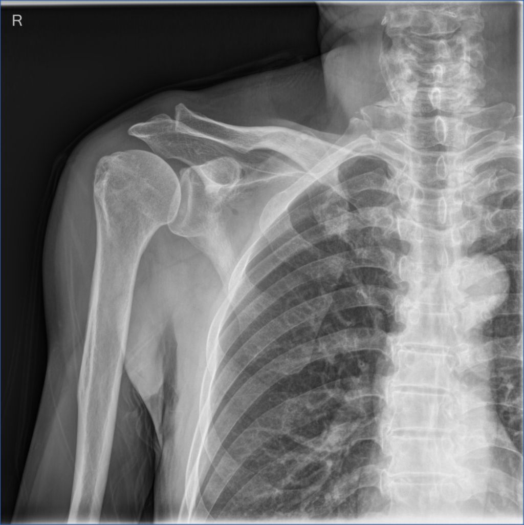 Quality digital X-ray images || 1