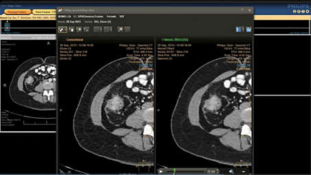 Multiple spectral results, viewable on PACS