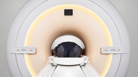 Add 10 years to your MRI lifetime