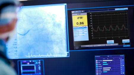 La modalité iFR, facteur de simplification du processus de travail
