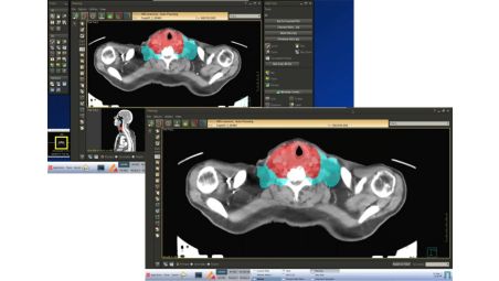 Integrazione di Pinnacle Evolution con Sun Nuclear PlanIQ™