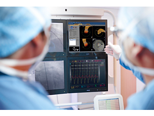HeartNavigator Making the difference with Live Image Guidance