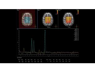 Spektroskopie Klinische MR-Anwendung