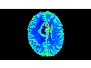 T2* Perfusion Klinische MR-Anwendung