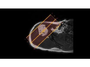 SmartExam Schulter Klinische MR-Anwendung