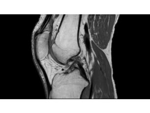 3D MSK VIEW Klinische MR-Anwendung