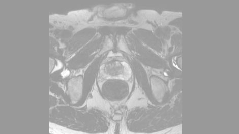 3D PelvisVIEW Klinische MR-Anwendung